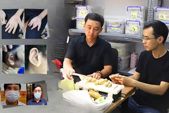 Đôi bạn Hà thành 'biến silicon thành da thịt' cho người khiếm khuyết