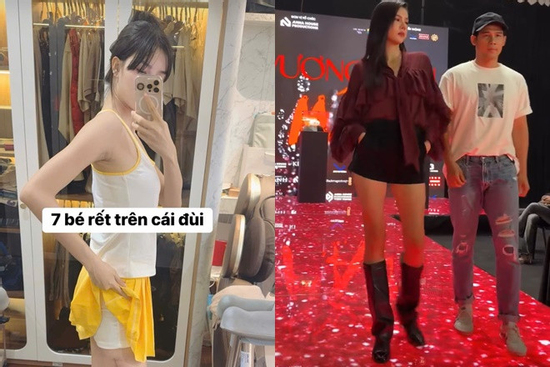 Vợ Mạc Hồng Quân catwalk trở lại sau 6 tháng gãy đùi, bị soi chân 'con rết' kém thẩm mỹ