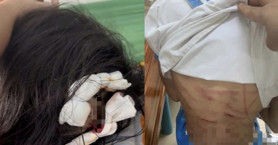 Cha dượng dùng búa bạo hành con riêng ở Hà Tĩnh sẽ đối diện mức án nào?