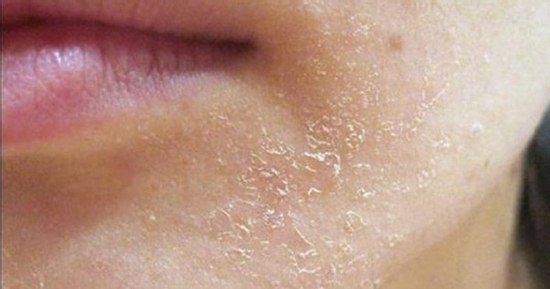 Làn da vào thu: Khi dưỡng ẩm trở thành 'chìa khóa' vàng