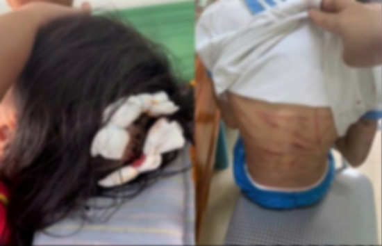 Từ đòn roi trong nhà đến ‘bạo lực biểu diễn’ trên TikTok: Trẻ em đang bị tổn thương ở mọi nơi