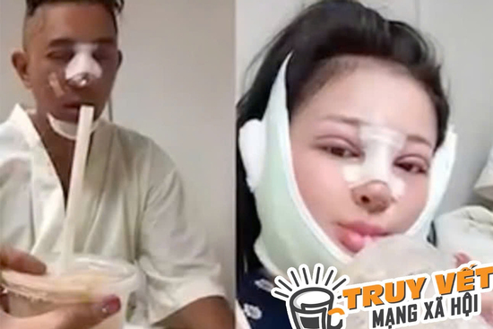 Bác sĩ Chiêm Quốc Thái phủ nhận làm biến dạng mũi Ngân 98