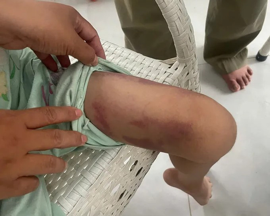 Tạm giữ mẹ ruột và bạn trai vì hành hạ bé gái 9 tuổi ở TP.HCM