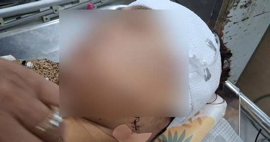 Nghi vấn nữ cán bộ xã ở Đồng Tháp rạch mặt người phụ nữ nhậu với chồng