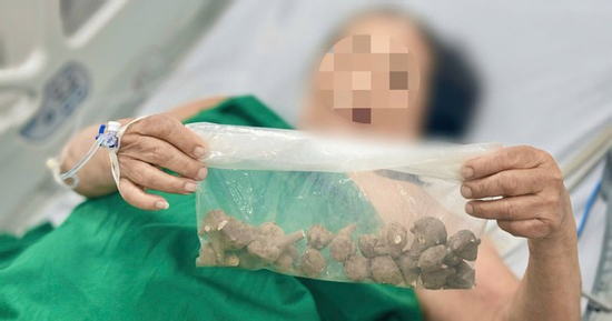 Người phụ nữ 78 tuổi nguy kịch do tự ý dùng loại củ này chữa đau khớp