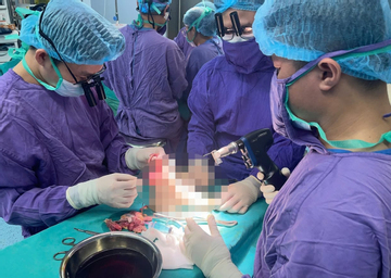 Nối lại chân đứt lìa cho nữ sinh 19 tuổi sau va chạm với mô tô phân khối lớn