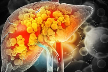 Lưỡi cho biết bạn khỏe mạnh hay không! Xuất hiện 3 dấu hiệu này, rất có thể gan hoặc dạ dày đang 'kêu cứu'!