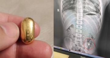 Con trai nuốt miếng vàng của mẹ vào bụng và cái kết