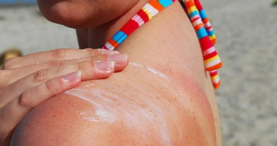 Tác hại của việc không dùng kem chống nắng
