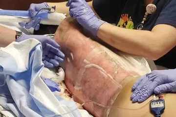 5 thử thách TikTok cực nguy hiểm, có một thử thách từng giết chết hơn 100 người