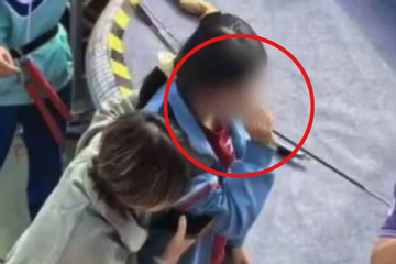 Nữ sinh bị bắn tên trúng mặt trong hội thi thể thao của trường