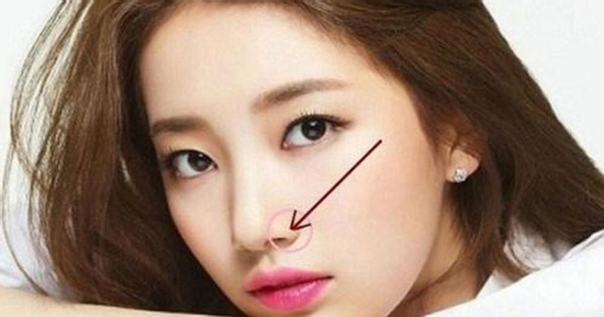 4 vị trí nốt ruồi dễ khiến tài vận biến động, tiền bạc khó tụ