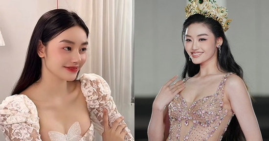 Không thể nhận ra Hoa hậu Yến Nhi hậu công khai nâng ngực, sửa mũi