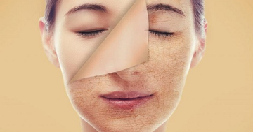 Cách chăm sóc da mùa đông phòng nứt nẻ