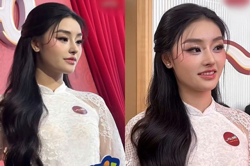 Nhan sắc lạ lẫm của HH Yến Nhi hậu phẫu thuật thẩm mỹ