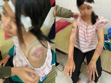 Ba kẻ tra tấn cháu gái suốt 4 giờ có thể bị khởi tố thêm nhiều tội danh