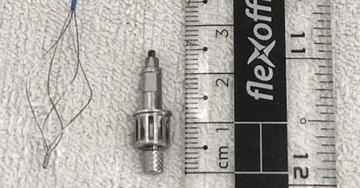 Người đàn ông bị dụng cụ nha khoa rơi vào phổi khi làm răng