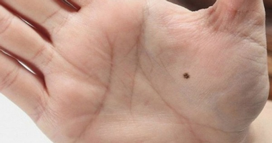 4 vị trí nốt ruồi phú quý, ai sở hữu đều có cuộc đời giàu sang, phúc lộc đủ đầy