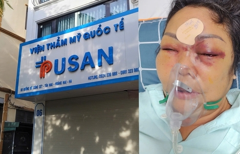 Nâng mũi cải vận nhận lại nỗi đau: Luật sư nói gì việc chối bỏ trách nhiệm sau tiêm filler gây mù mắt khách hàng?