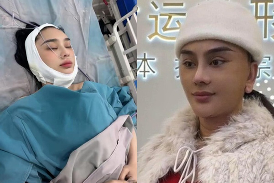 Lâm Khánh Chi gây hoang mang khi tiếp tục 'dao kéo' sau 1 tháng sửa mắt, căng da cổ