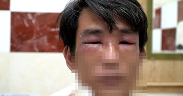 TP HCM vào mùa kiến ba khoang: cảnh báo người dân kiểm tra chăn màn