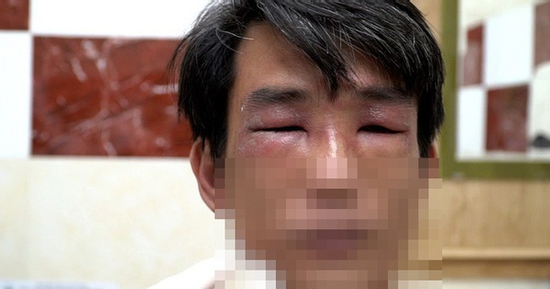 TP HCM vào mùa kiến ba khoang: cảnh báo người dân kiểm tra chăn màn