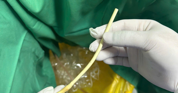 Con hốt hoảng khi cụ ông cắt phăng thiết bị y tế vì 'loằng ngoằng'