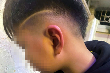 Công an vào cuộc vụ bé trai 12 tuổi ở Hà Nội nghi bị bố bạn học hành hung