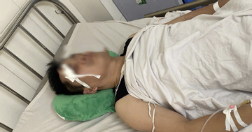 Xe buýt va chạm nhẹ với xe con, tài xế bị đánh chấn thương