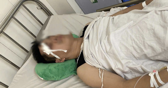 Xe buýt va chạm nhẹ với xe con, tài xế bị đánh chấn thương