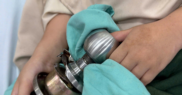 Hi hữu: Bé trai 5 tuổi bị kẹt ngón tay cái vào ổ khóa