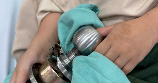 Hi hữu: Bé trai 5 tuổi bị kẹt ngón tay cái vào ổ khóa