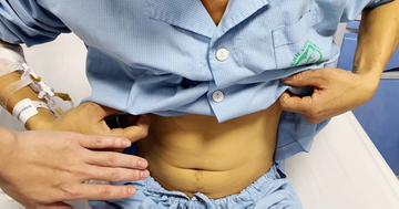 Người đàn ông trẻ suýt tử vong vì uống mật cá trắm để tăng sinh lực