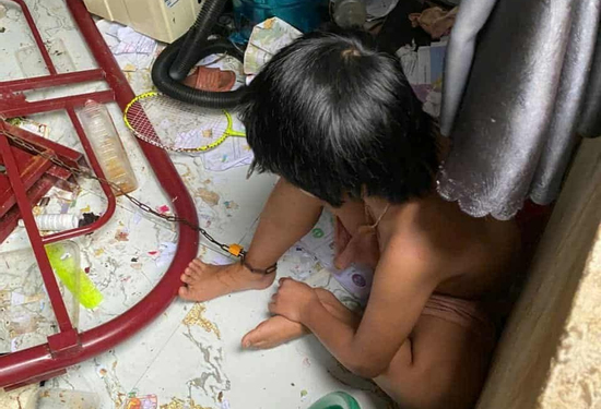 Giám định thương tật 2 bé gái bị cha xích, nhốt trong căn phòng bẩn thỉu