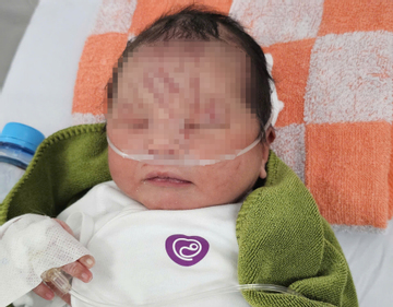 Nhiều người muốn nhận nuôi bé sơ sinh bị bỏ rơi ở Gia Lai