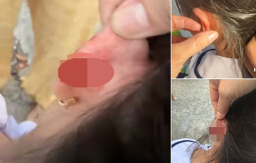 Xác minh vụ giáo viên tiểu học véo tai học sinh lớp 1 chảy máu ở Phú Quốc