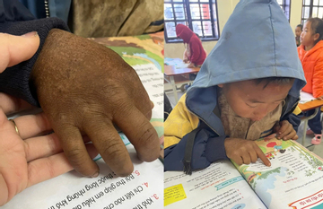 Hình ảnh bàn tay nứt nẻ của cậu bé 8 tuổi vùng cao khiến triệu người nghẹn lại