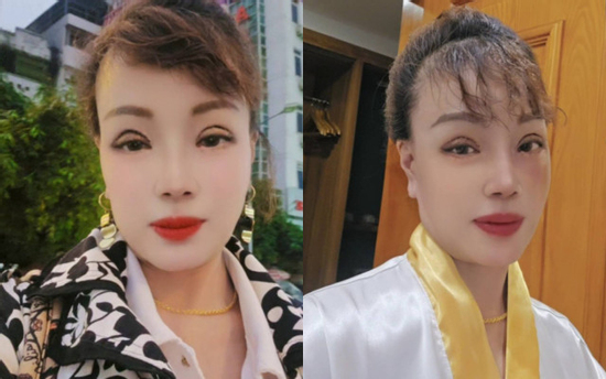 'Đứng hình' diện mạo của 'cô dâu Cao Bằng' sau khi thẩm mỹ ở tuổi U70