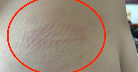 Cô giáo bị tố đánh, xưng