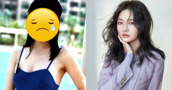 1 Hoa hậu hàng đầu bị cúm và viêm phổi giống Từ Hy Viên