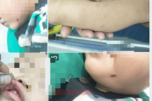 Nữ giáo viên đánh trẻ dã man: Kết quả điều tra ban đầu từ Công an Quảng Nam