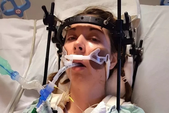 Bị 'rụng đầu khỏi cổ', người phụ nữ trải qua 37 ca phẫu thuật để giữ tính mạng