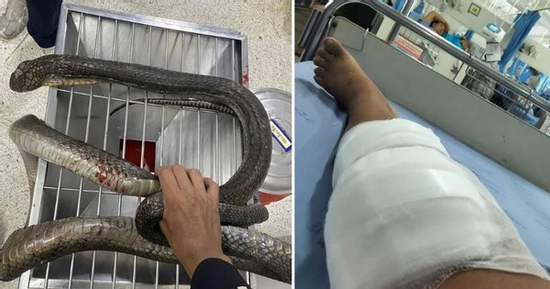 Bị rắn hổ mang cắn, người phụ nữ 47 tuổi tay không hạ gục con rắn rồi mang đến bệnh viện