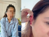 Kết quả giám định vụ cô gái cầu cứu sau khi bị bạn cùng phòng trọ hành hung rách tai vì lấy nhầm nồi nấu ăn