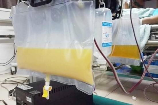 Lý do khiến huyết tương người đàn ông đục như nước gạo