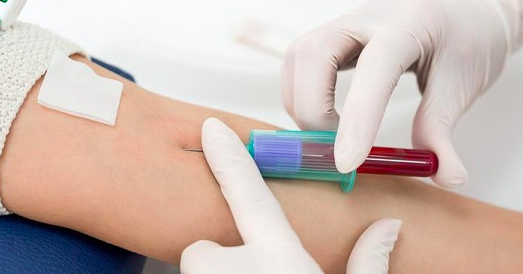 Người dân đổ xô xét nghiệm dấu ấn ung thư, chuyên gia nói gì?