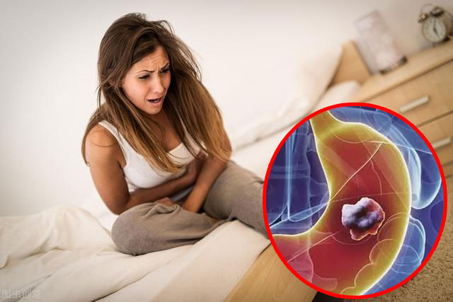 Ngày càng nhiều người bị ung thư dạ dày! Xuất hiện 5 triệu chứng nên kiểm tra