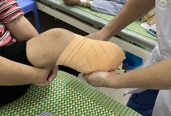 Bác sĩ thức trắng đêm để cứu bệnh nhân khỏi lằn ranh sinh - tử: Xin đừng chủ quan ngay cả những vết thương nhỏ tưởng chừng vô hại