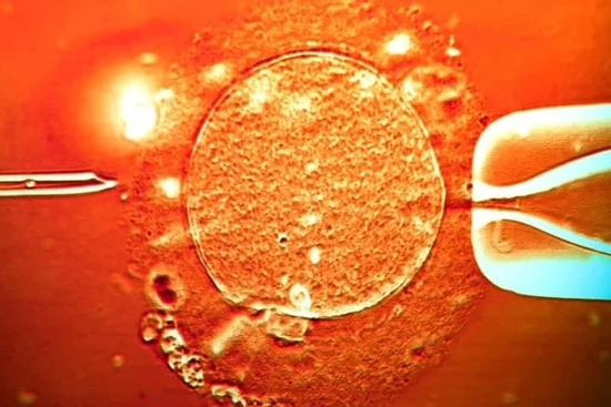 67 trẻ sinh ra từ tinh trùng người hiến mang gene ung thư, 10 trẻ mắc bệnh