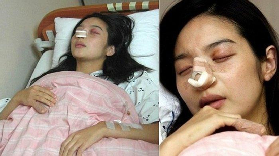 Nữ diễn viên kết thúc cuộc hôn nhân địa ngục chỉ sau 12 ngày, do bị chồng hành hung đến sảy thai giờ ra sao?